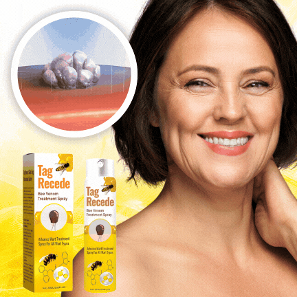 DERMATÓLOGOS SORPRENDIDOS: ESTE SPRAY ELIMINA VERRUGAS EN 7 DÍAS SIN DEJAR CICATRIZ ¡PAGA 1 Y LLEVA 2!